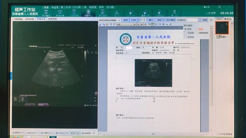 体检套餐的分类标准主要基于以下几个方面：